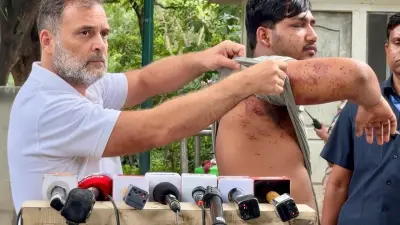 Rahul Gandhi Pellet Gun Victim Press Conference Sparks Row